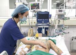 Gia tăng ca mắc thủy đậu, cảnh báo nguy cơ biến chứng nặng